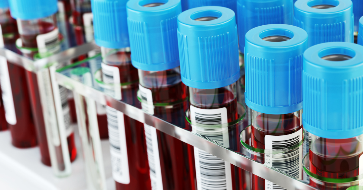 Blood Vials Awaiting Analysis In A Laboratory