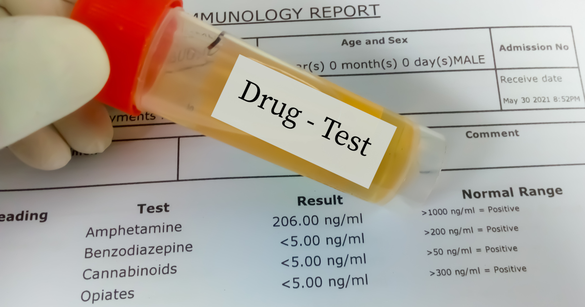 Fingers In Latex Gloves Gripping A Vial Flul Of Amber-Colored Liquid And Labeled Drug Test, With A Prinout Of A Drug Test Results In The Background