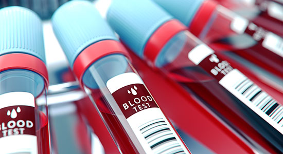 blood test